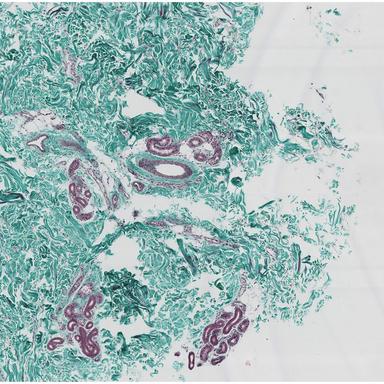 X Marks the Spot - Boxed in Remix